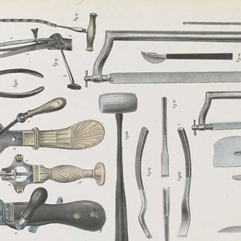como-eram-Instrumentos-utilizados-primeiras-cirurgias